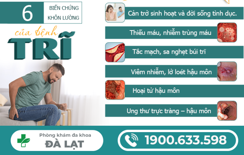 Hình ảnh minh họa